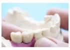 Best Dental Clinic in Noida for Complete Oral Care – Book Your Consultation Today!