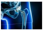 Total Hip Replacement Surgery in Amritsar