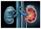 Kidney stone treatment Hospital in Hoshiarpur