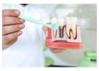 Best Dental Implant Clinic in Kolkata