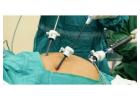 Best Hospital for Gallstone Surgery in Kolkata