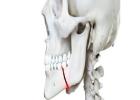 Best Jaw Fractures clinic in Dubai UAE