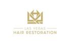 Las Vegas Hair Restoration