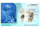 Best Knee Replacement Surgeon in Bangalore: Dr. Nataraj H M 