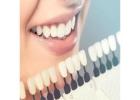 Best Cosmetic dentistry treatment in Dubai UAE