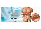 Best Doctor for Gallbladder Stone Surgery in Kolkata