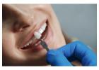 Implant Dental Clinic