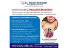 Vasculitis in Children: How It Differs from Adults