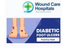 Best Diabetic Foot Ulcer Treatment in Hyderabad | Kukatpally | KPHB - WCH