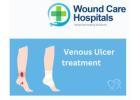 Best Venous Ulcer treatment in Hyderabad | Kukatpally | KPHB - WCH