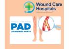 Peripheral Arterial Disease Treatment in Hyderabad | kukatpally - WCH