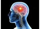 Traumatic Brain Injury Treatment in Trivandrum