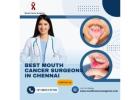 Oral Cancer Treatment Doctors In Chennai | +91 96633 03747