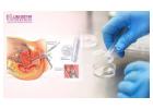 Get the Best IVF Treatment Cost in Pune with Low Cost IVF Treatment