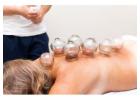 Experience the Benefits of Cupping Therapy in Brooklyn!