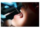 Expert General Dentistry in Philadelphia from My Smile For Life