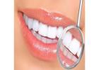 Best Esthetic dentistry treatment in Dubai UAE