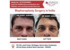 Blepharoplasty Surgery in India: Rejuvenate Your Eyes with Expert Care