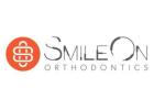 Braces in Round Rock | SmileOn Orthodontics