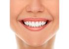 Smile Brighter with Expert Teeth Whitening service in Burton