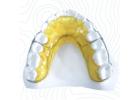 China Orthodontic Lab: Premium Wrap Around Retainers for Stability