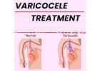 Homeopathic Treatment for Varicocele by Bharat Homeopathy-Potent Varicocele