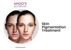 Advanced Pigmentation Treatment at Anoos