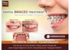 Best Braces Clinic in Vanasthalipuram |Best Braces Dentist - FMS Dental