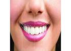 Best Smile designing treatment in Dubai UAE