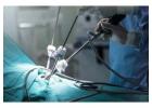 Leading Hospital for Laparoscopic Surgery in Kolkata – Genesis Hospital