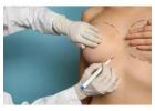 Breast Augmentation Surgery in India by Dr. Priya Bansal