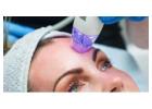 Best Treatment For RF Microneedling in Wanstead