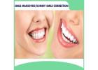 Best Smile Makeover treatment in Dubai UAE