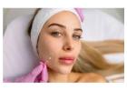 Thread Lift Treatment in Delhi