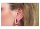 Earlobe Repair treatment in Delhi - Lobuloplasty at Skinology