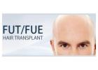 Best hair treatment for hair loss - Hair loss in women