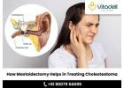 Mastoidectomy for Cholesteatoma Treatment | Multi-speciality Surgical Day Care in Kolkata