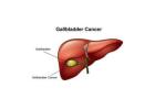 Best Gallbladder Cancer Treatment in Ludhiana