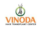 Best Hair Transplant Clinic in Hanamkonda