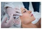 Best Anti-Wrinkle Injections in Clapham