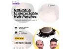 Natural & Undetectable Hair Patches- Hair Fixing Zone