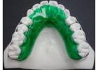 Midway Dental Laboratory: Trusted Clinic for Invisible Teeth Aligners