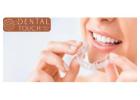 Key Things to Know Before Getting Invisalign In Leesburg