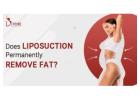 Transform Your Body with Liposuction in Delhi - Dr. Amit Gupta 