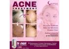 Best Acne Peel Treatment Clinic in Bhubaneswar – Get Clear Skin Today!