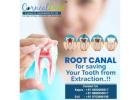 Root Canal Treatment in Hyderabad