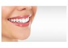 Teeth Whitening in Sydney – Restore the Natural Shade of Your Teeth