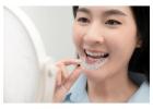 Affordable Orthodontics Best Invisalign Dentistry in San Diego