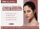 Say Goodbye to Dark Circles with Expert Treatments