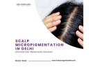 Scalp Micropigmentation Treatment in Delhi